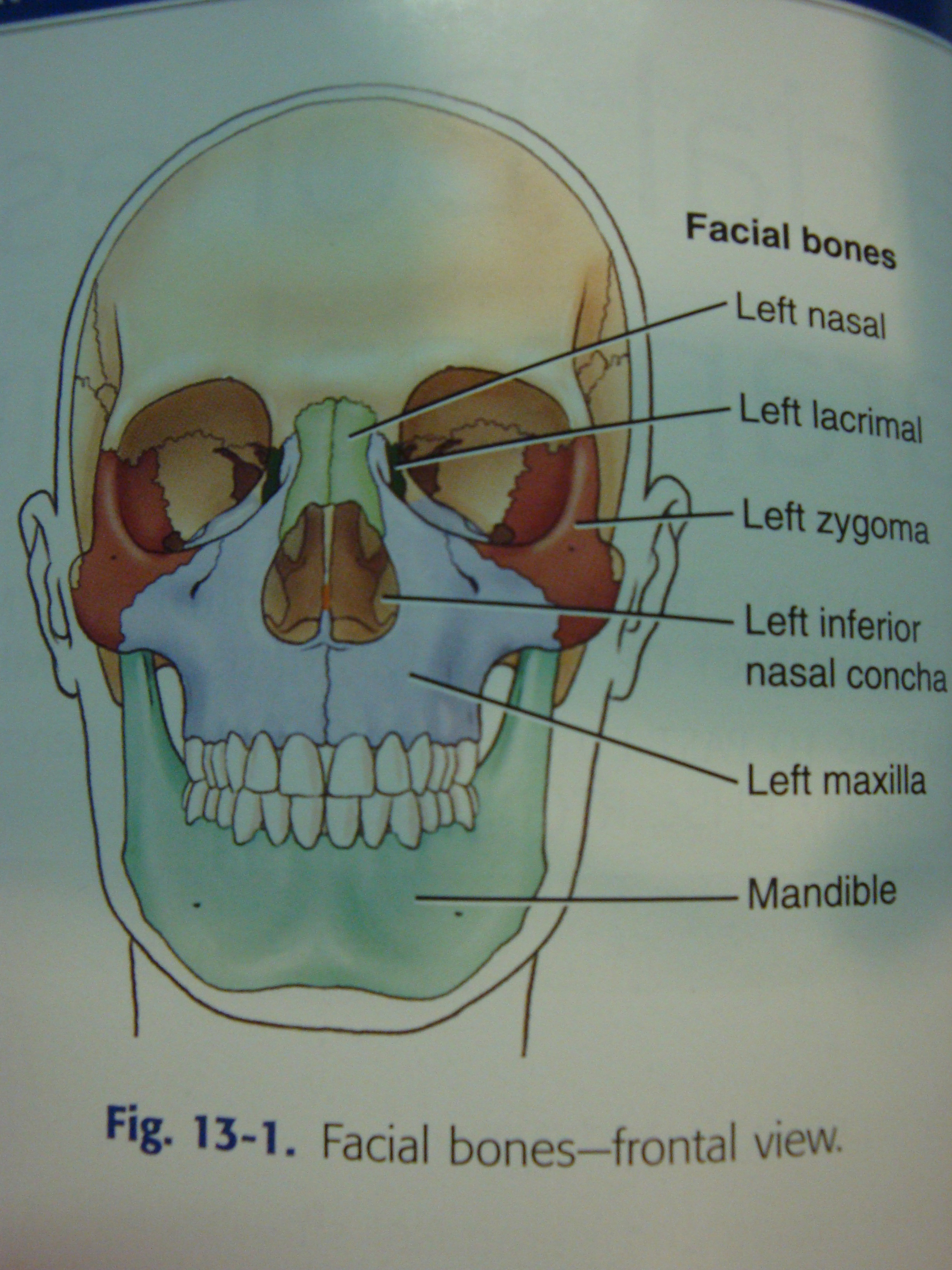 New CMAP for Facial Bones and Parasinuses